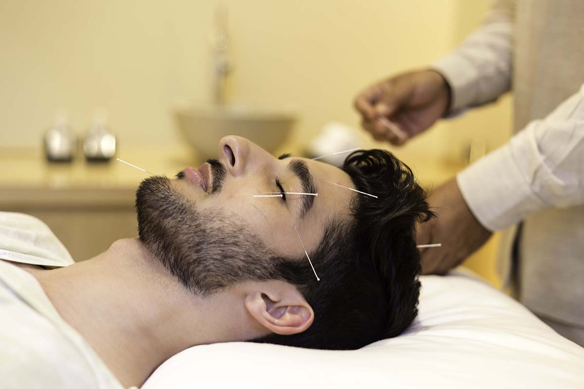 An acupuncture treatment at Vana Wellness Retreat